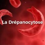 Drépanocytose au Bénin : une vaste campagne gratuite de dépistage lancée dans les 12 départements